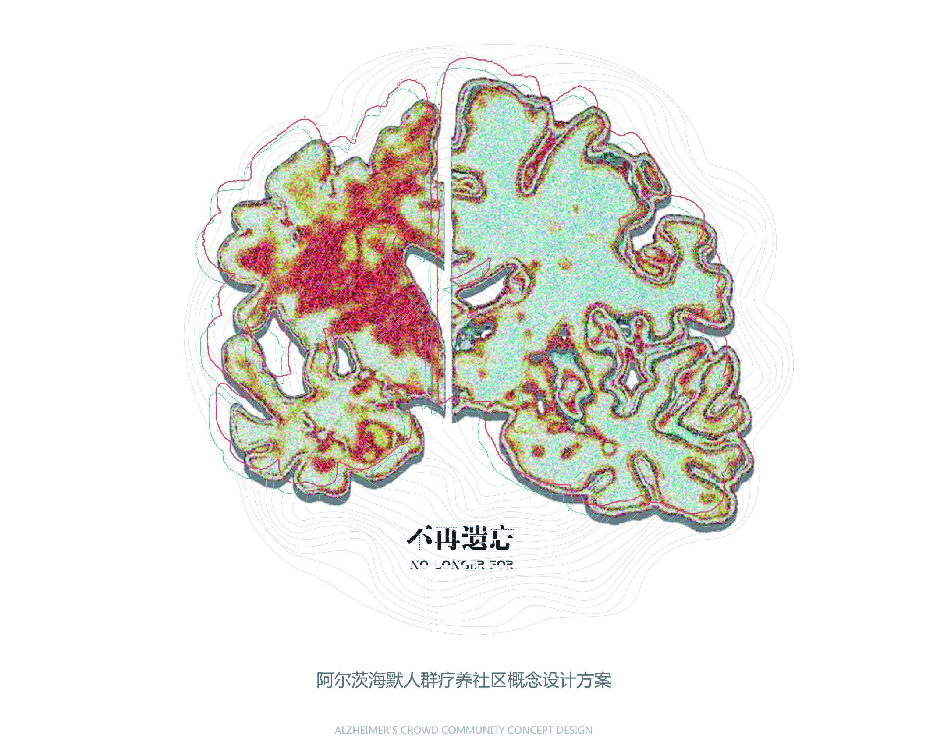 不再遗忘——阿尔兹海默人群疗养社区概念设计方案